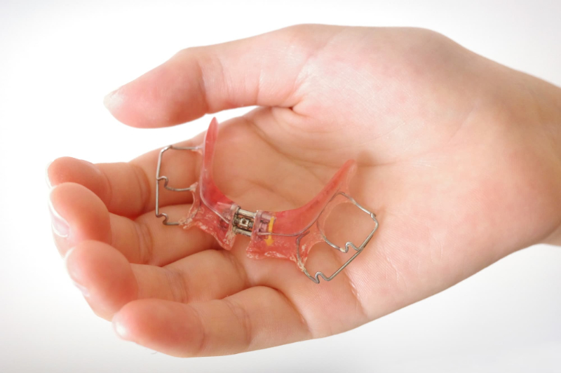 子どもの手のひらにのった下顎の床矯正の装置
