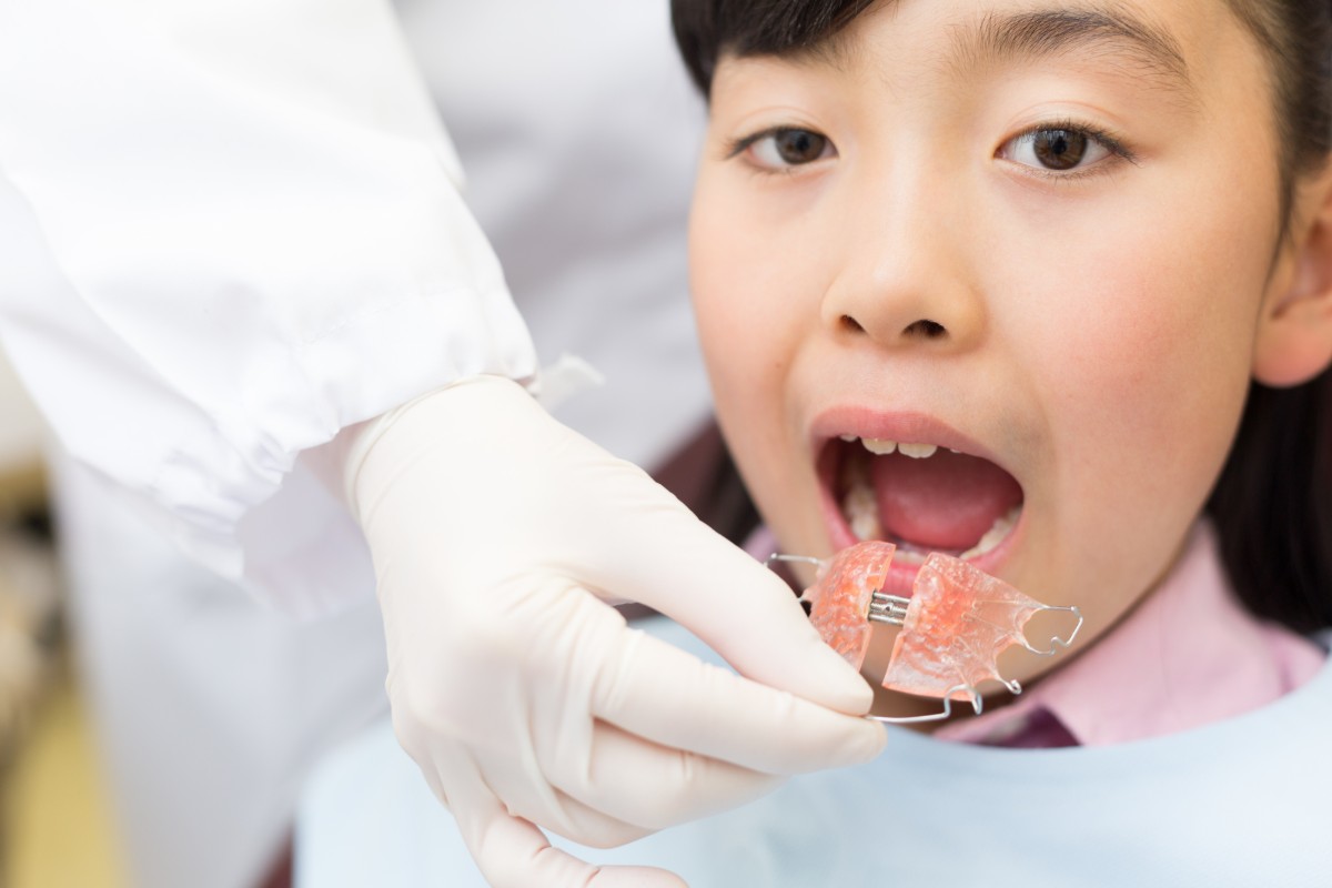 小児矯正治療中の子ども