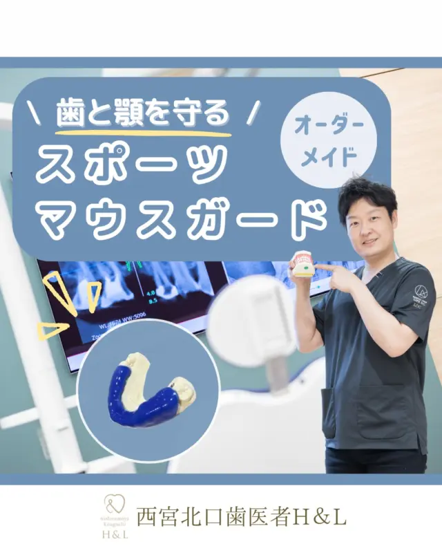 \歯と顎を守るスポーツマウスガード/

スポーツマウスガードとは...
スポーツを行う際に、歯と顎を守る目的で使用するマウスピースのことです！
マウスガードを装着することで、強い衝撃が加わっても歯や顎、脳への衝撃を軽減することができます✨

～スポーツマウスガードの効果～
①スポーツ中の歯の破折予防
②口周りの粘膜の損傷予防
③脳しんとうや顎関節障害の予防
④歯の磨耗予防
⑤歯で相手を傷つけてしまうことを防ぐ

当院では、既製品ではなく一人ひとりのお口の状態や、年齢、用途、費用に応じてオーダーメイドでマウスガードを提供しております🍀

スポーツマウスガードを検討されている方は、是非一度ご相談ください😊

〜ご家族皆様のお口に関する情報を発信いたします！コメントやDMからお気軽にご相談・ご質問くださいね〜

@nishinomiya.h_l.dc

📍医院情報
〒663-8204
兵庫県西宮市高松町5-39 なでしこビル4階
（西宮北口駅南改札から徒歩1分👣）

🏥診療時間
平日 9:30-19:00
土曜 9:30-18:30
日・水・祝 休診

#西宮北口H&L #西宮H&L #西宮歯医者 #西宮北口 #西宮北口歯医者 #西宮北口歯科 #スポーツ #スポーツマウスガード #マウスガード #マウスピース #スポーツマウスピース