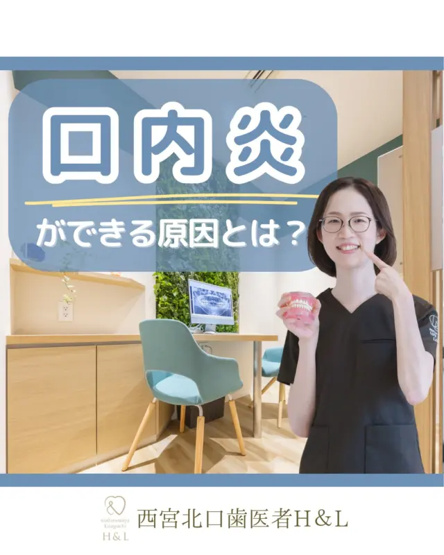 \口内炎ができる原因とは？/

口内炎とは口の中の粘膜に起こる炎症のことです💦

～口内炎ができる原因とは～
①疲れ、ストレス
②粘膜の傷、被せ物の不適合
③ウイルス、感染症
④アレルギー
⑤習慣的な喫煙

口内炎は、抵抗力や免疫が下がるとできやすくなり、生活習慣を見直すことで改善される可能性があります！

～口内炎を予防するには？～
①ビタミンB2、B6を含む食べ物を摂取する
②辛味や刺激物は控える
③生活習慣を整え、ストレス軽減
④口腔内を清潔に保つ

口内炎が治らない場合は歯科医院にて診察を受けることで改善されます✨
西宮北口歯医者では、塗り薬や内服薬、治療など症状に合わせて対応できますので、痛みがひどい場合は我慢せずにご来院ください！

〜ご家族皆様のお口に関する情報を発信いたします！コメントやDMからお気軽にご相談・ご質問くださいね〜

@nishinomiya.h_l.dc

📍医院情報
〒663-8204
兵庫県西宮市高松町5-39 なでしこビル4階
（西宮北口駅南改札から徒歩1分👣）

🏥診療時間
平日 9:30-19:00
土曜 9:30-18:30
日・水・祝 休診

#西宮北口H&L #西宮H&L #西宮歯医者 #西宮北口 #西宮北口歯医者 #西宮北口歯科 #口内炎 #生活習慣 #ストレス #食生活 #喫煙